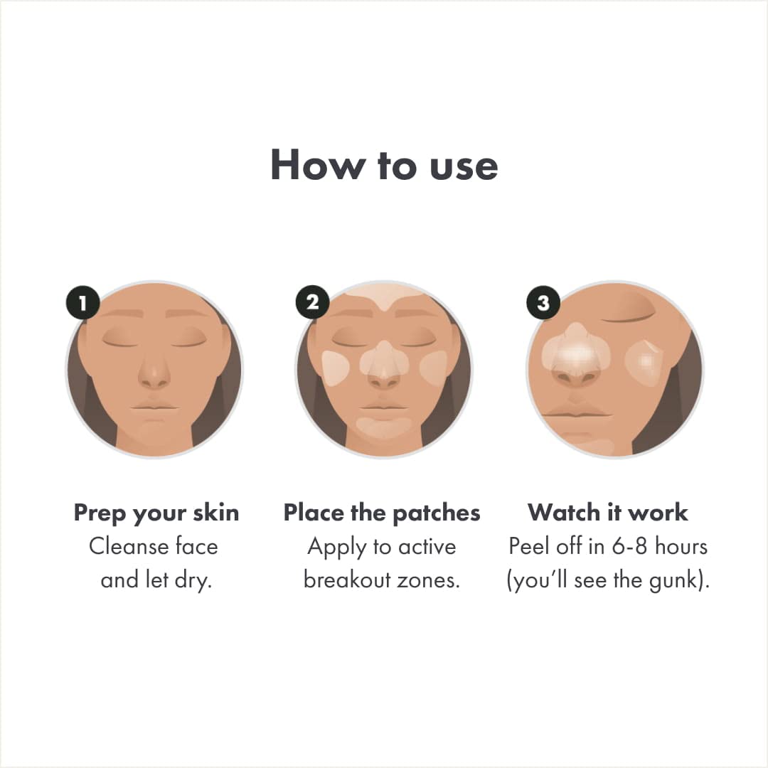 Hero Cosmetics Mighty Patch™ Face Patch - XL Hydrocolloid Face Mask for Acne, 5 Large Pimple Patches for Zit Breakouts on Nose, Chin, Forehead & Cheeks (1 Count)