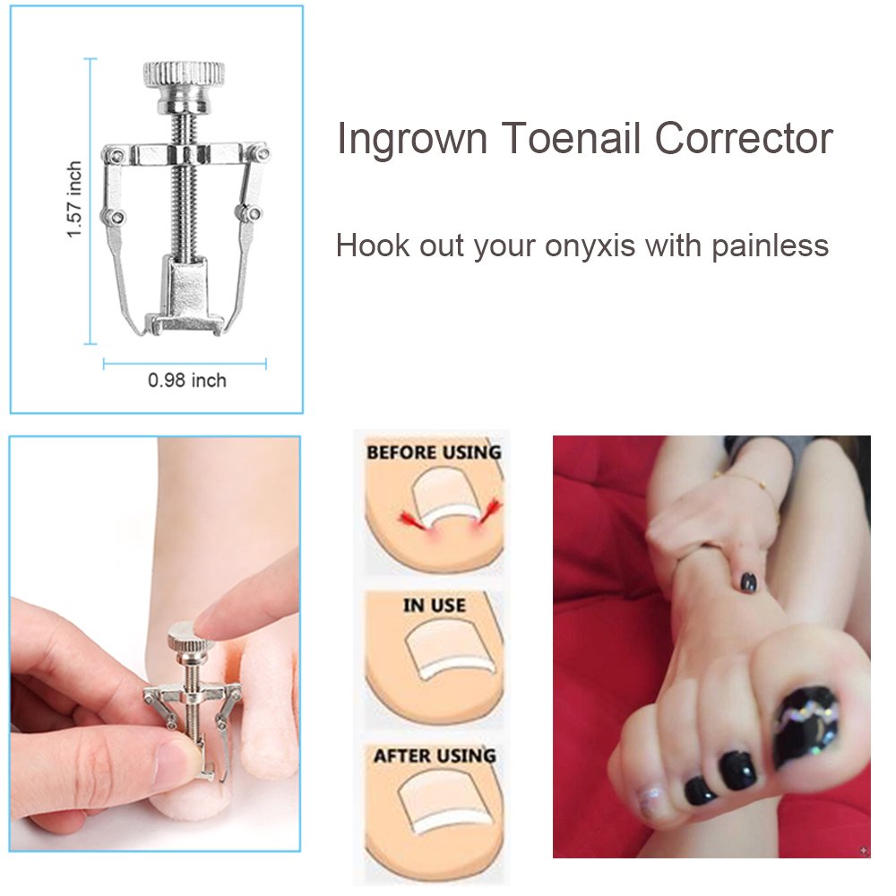 Bcabo 10Pcs/set Ingrown Toenail Tools Kit, Nail Treatment Foot Tool,Ingrown Toenail Removal Correction Clippers, Surgery Grade Nail File Lifter, Professional Pedicure Tool