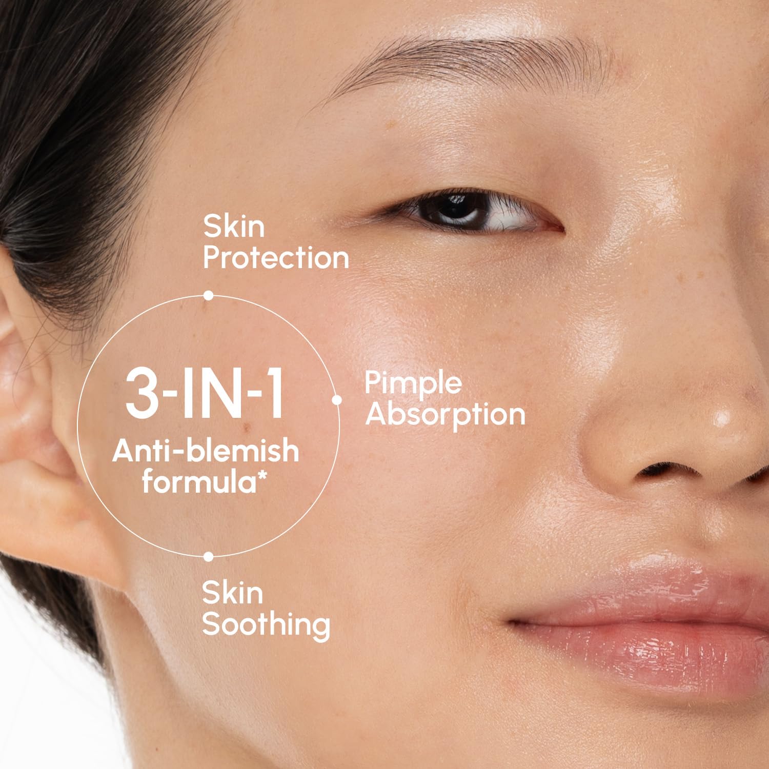 MAREE Pimple Patches for Face - Acne Clearing Device - Clear Acne Patches for Face - Invisible Hydrocolloid Patch Parches Para Acne Stickers Zit Dots - Cystic Zit Healing Blemish Pinple Covers