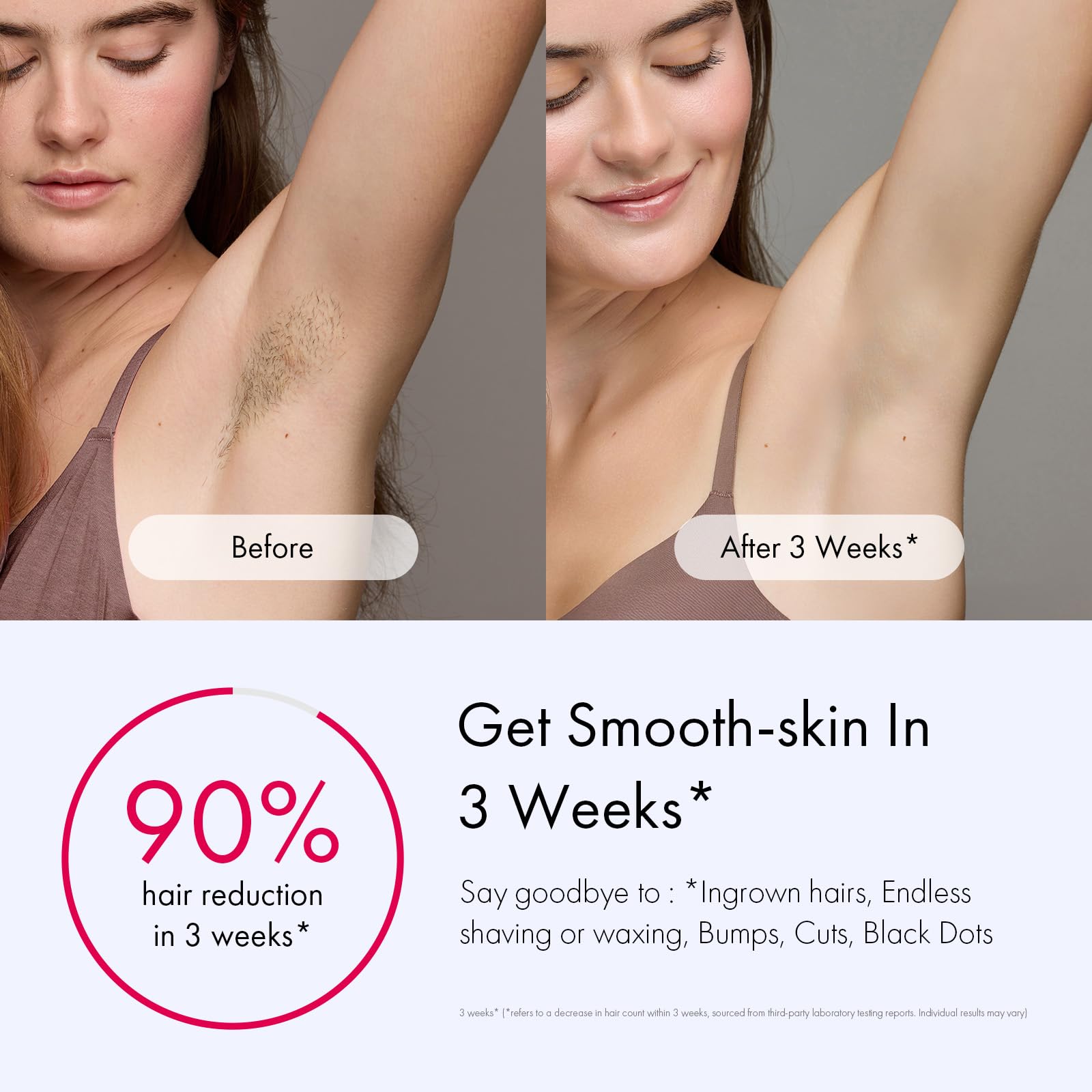Ulike Laser Hair Removal for Women and Men, Air 3 Ice-Cooling IPL Device Hair Removal for Nearly Painless & Long-Lasting Results, 3 Modes & Auto Flashing for Fast Full Body Hair Removal from Home