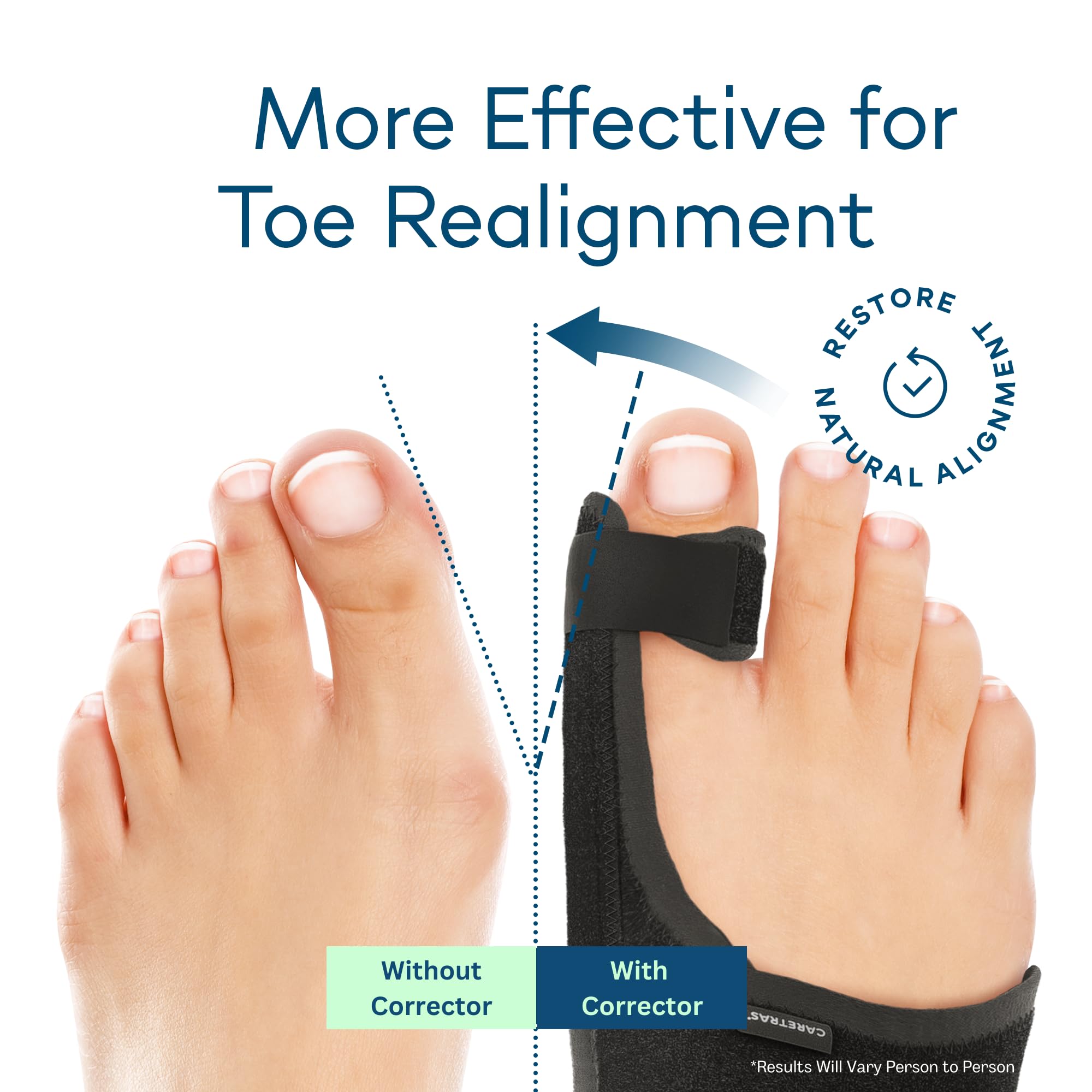 Caretras 2-Pack Bunion Corrector for Women & Men, Orthopedic Bunion Splint for Hallux Valgus Pain Relief, Big Toe Separator, Adjustable Day/Night Support, Comfortable Hammer Toe Straightener