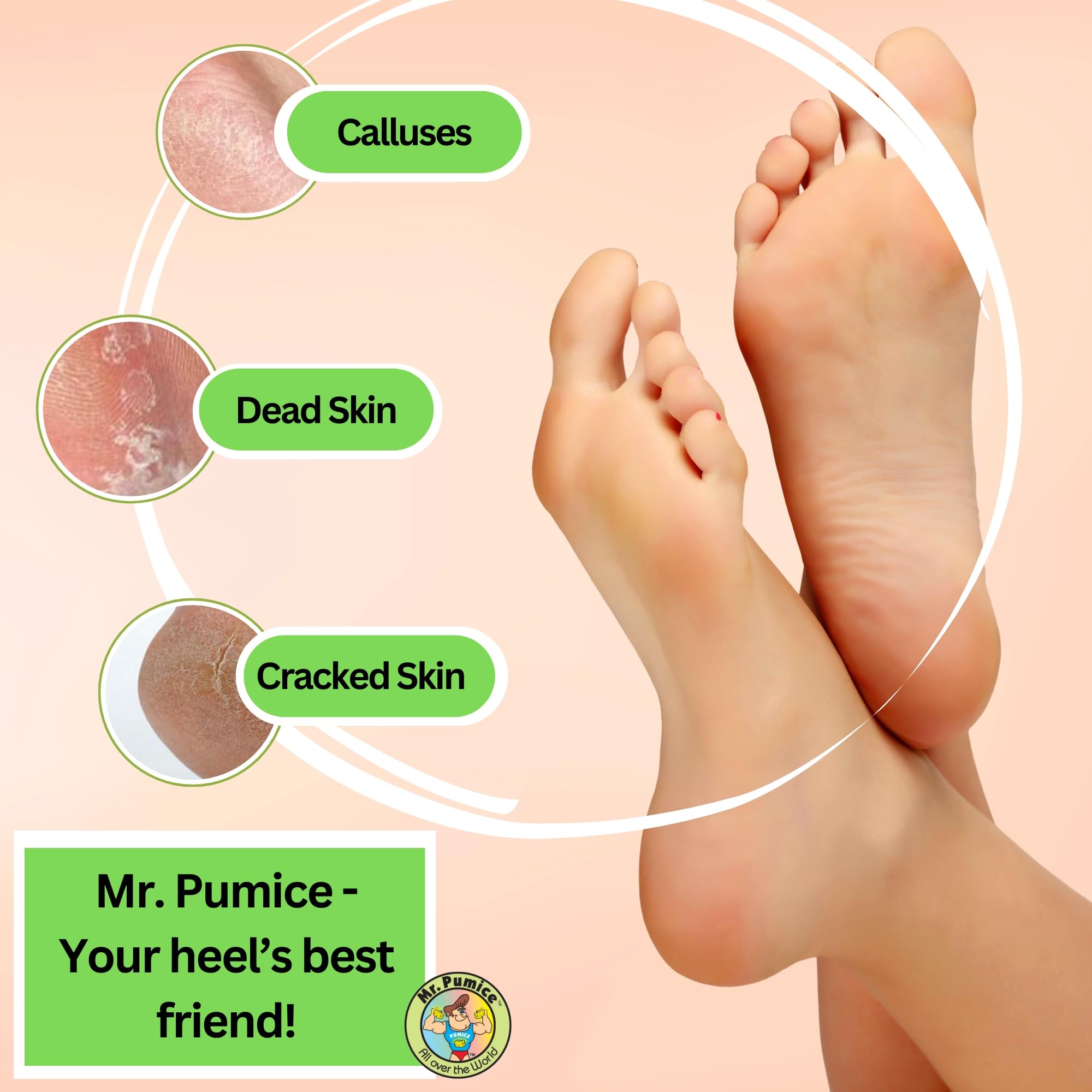 Mr. Pumice Callus Remover PUMI Bar: Pedicure Stone & Foot/Heel Scrubber - Medium Grit (Assorted Colors) 4 Pack