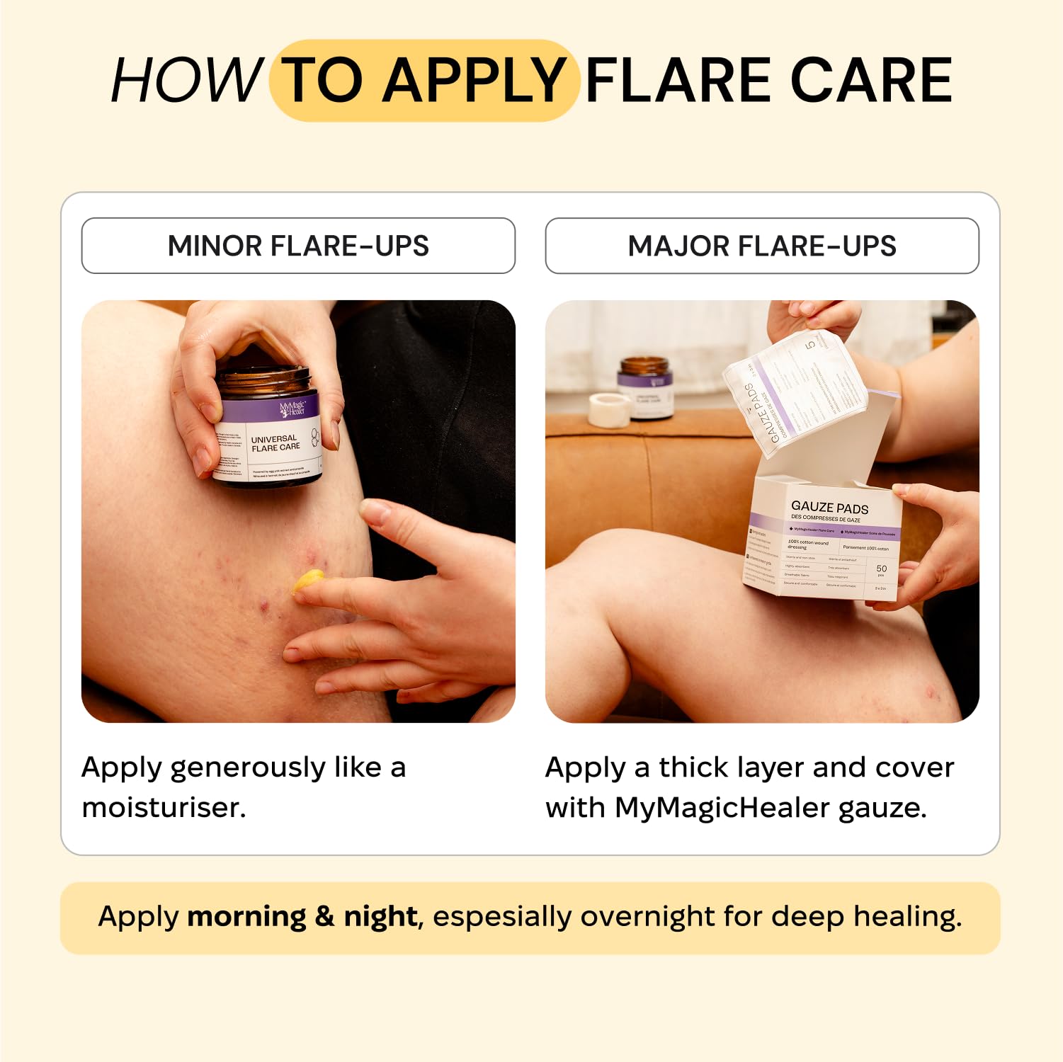 MyMagicHealer Universal Flare Care | Drawing Salve for HS, Boils, Cysts, Hemorrhoids, Pilonidal Cyst, Abscess | Anti-Chafing, Wound Care, Relief for Itching Skin w/Propolis & Egg Yolk Extract 1 oz