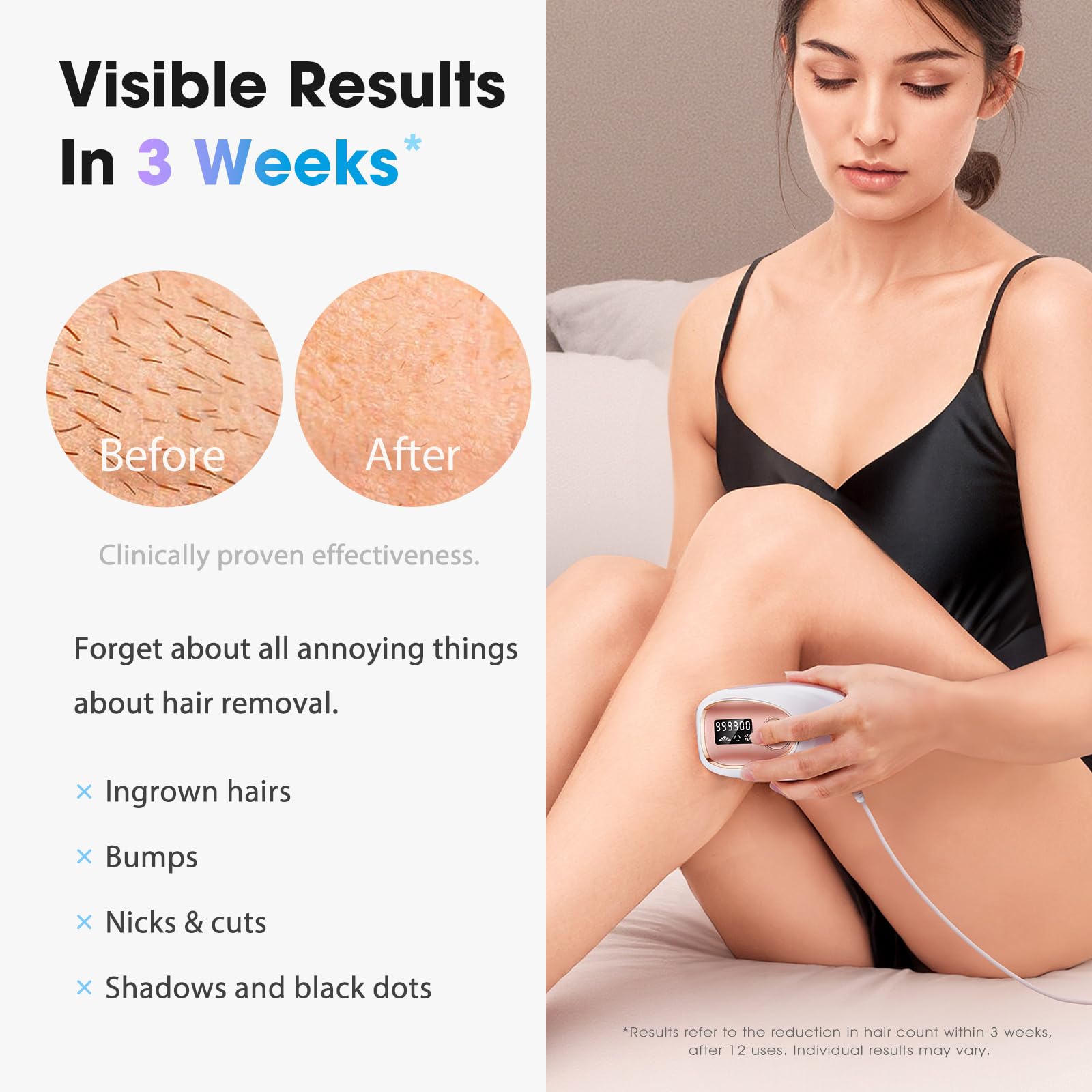 Oreeth IPL Laser Hair Removal Device for Women & Men - Home 45°F Ice-Cooling Contact for Painless & Long-Lasting Results, 86% Hair Reduction in 3 Weeks for Full Body & Bikini Line, Rose Gold